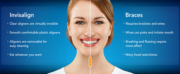 Braces