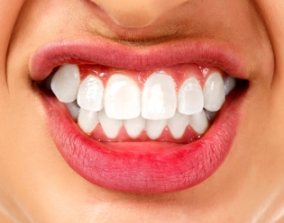 Bruxism-and-teeth-grinding